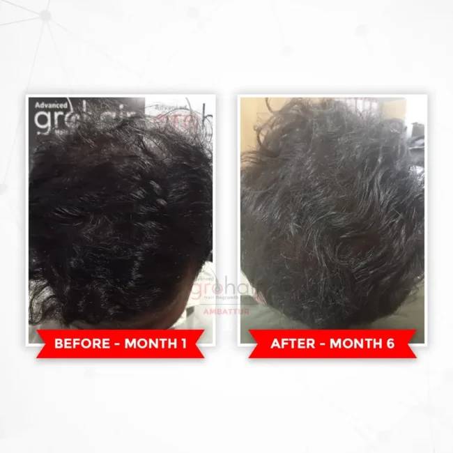 Before - Transformation 1