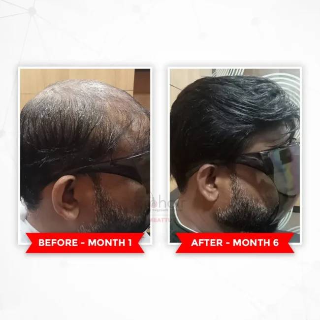 Before - Transformation 2