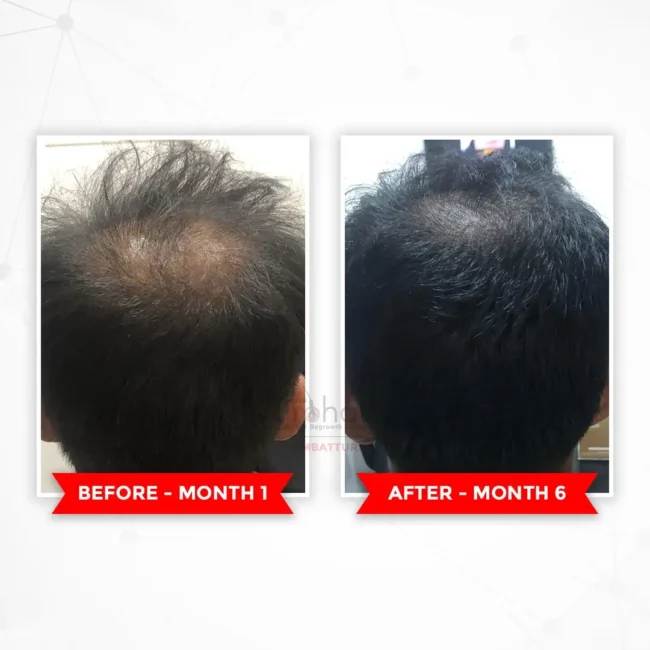 Before - Transformation 3